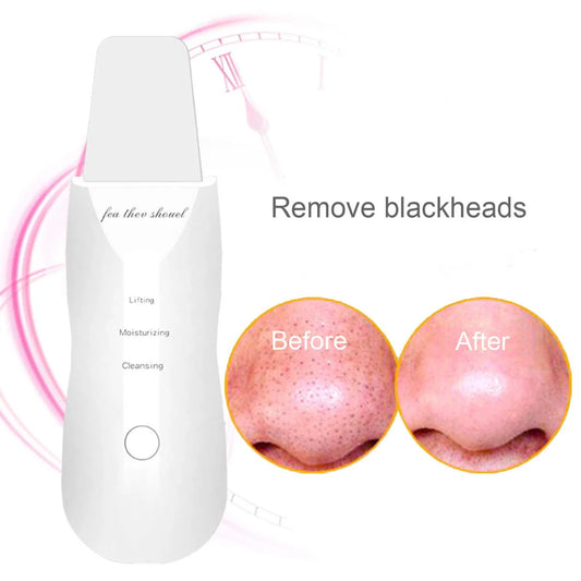 Ultrasonic Skin Scrubber Ultrasuoni Viso Pulizia Face Skin Peeling (IN OMAGGIO 1 CREMA EFFETTO LIFTING+1 CREMA IDRATANTE VISO)